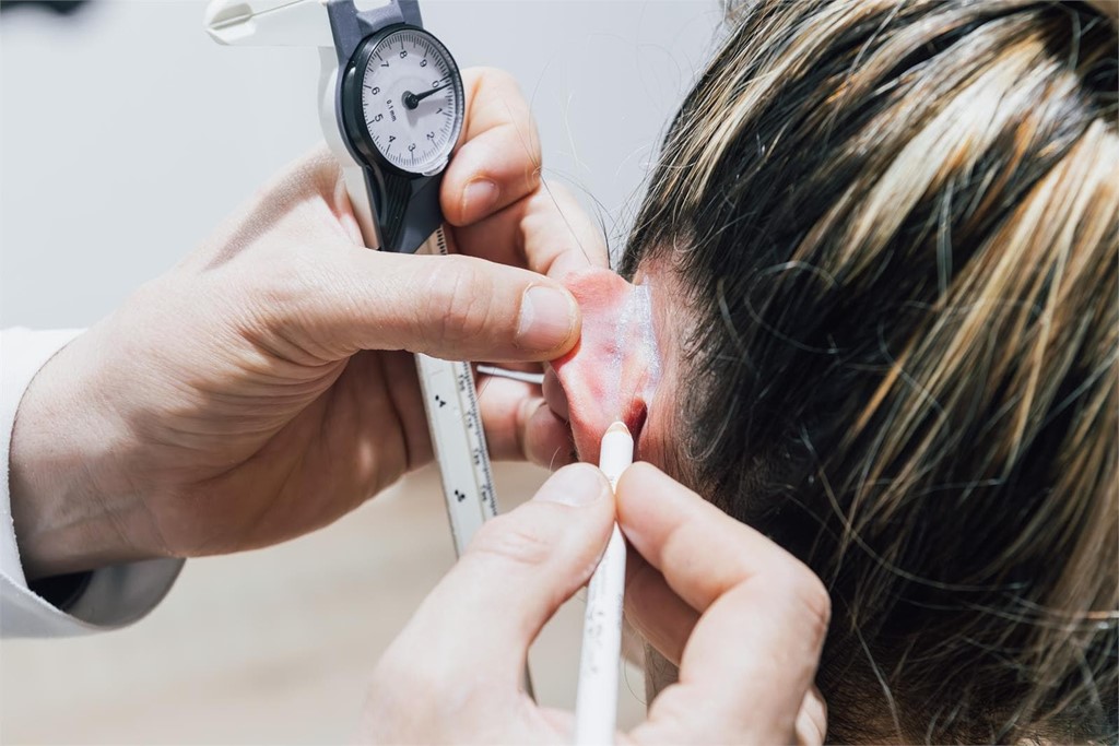 ¿En qué consiste la otoplastia?